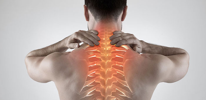 Man with upper back pain before chiropractic treatment from Lake Worth chiropractor