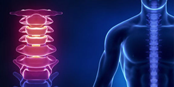 Neck Pain Care Lake Worth