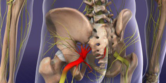Sciatica Care Lake Worth