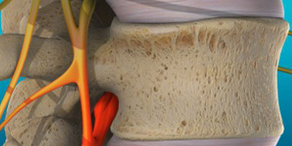 Vertebral Subluxation Lake Worth